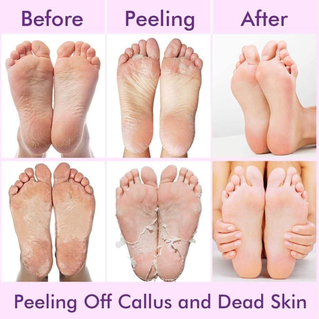 Exfoliating Foot Mask Hydrating Sock Pedicure Essential - PURE