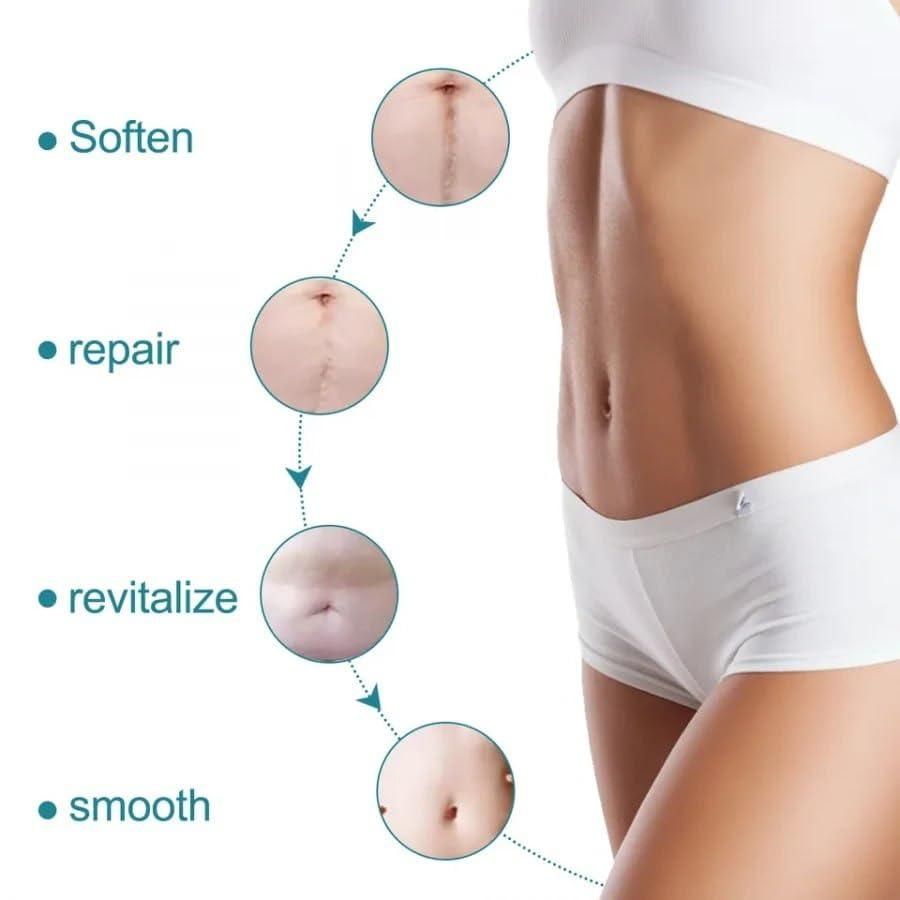 Silicone Scar Sheets, Silicon gel sheets for Scars Transparent Medical Silicone Gel Tape - PURE