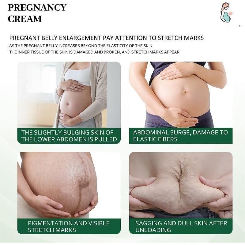 KURAI Pregnancy Scars, Acne Remove Cream - PURE