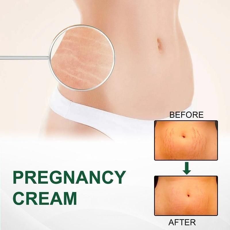 KURAI Pregnancy Scars, Acne Remove Cream - PURE